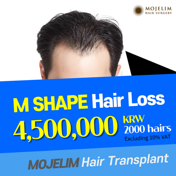 Male M Shape Hair Transplantation