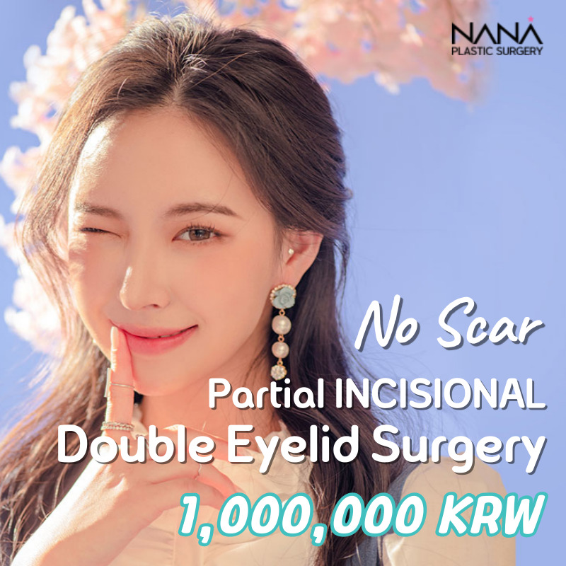 Double Eyelid Surgery by No Scar Partial Incision method
