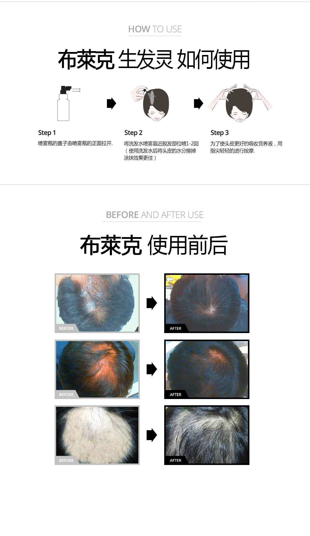 布萊克 毛发再生洗发水 250ml/韩国原装正品/韩国直邮 5