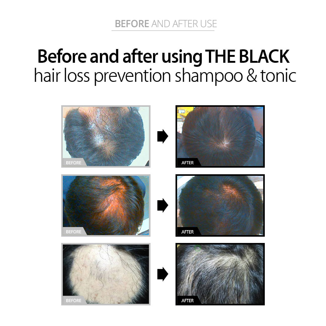The BLACK Hair Boosting Shampoo 250ml / Authentic / International Shipping from Korea description 5