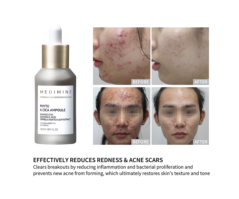 MEDIMINE Phyto A.CICA Ampoule description picture 2