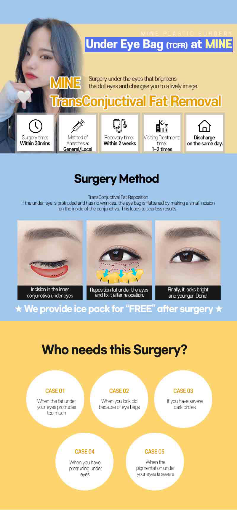 Under eye bag removal (TCFR) explains of MINE Plastic Surgery in Korea