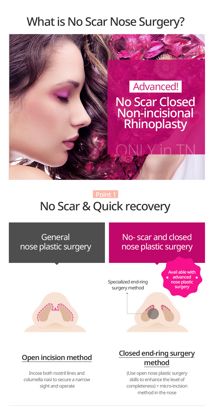 TN x AllaboutMEI special offer / no scar nose surgery in Korea with quick recovery