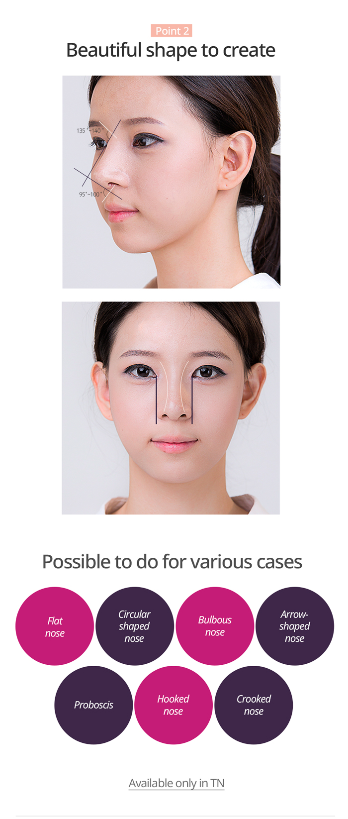 TN x AllaboutMEI special offer / beautiful and natural shape to create by no scar rhinoplasty
