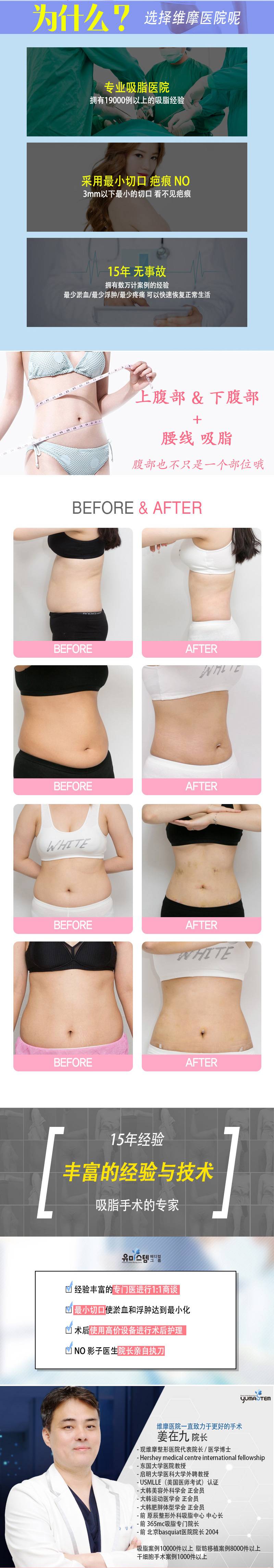 2021年3月，韩国维摩医院专门从事抽脂手术，为腹部，爱手柄，背部抽脂提供了很大帮助