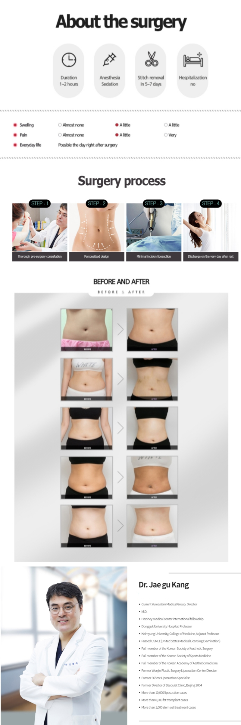 YUMASTEM clinic x AllaboutMEI special offer / promotion / mini liposuction