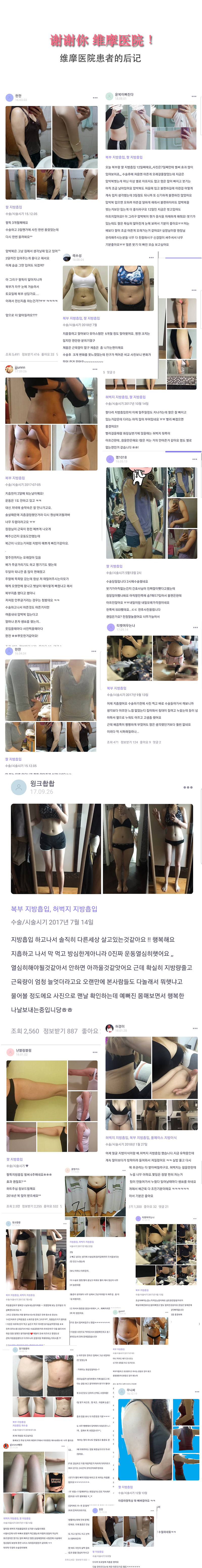 韩国维摩医院患者后记和前后对比照片，手臂吸脂前后照片，腹部吸脂前后对比照片，患者后记