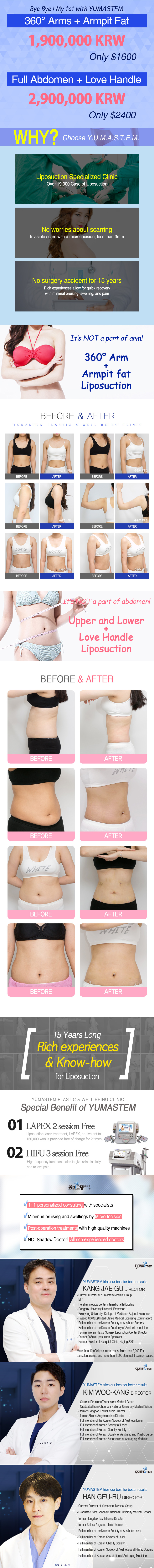 Why you should choose YUMASTEM liposuction? specialist of liposuction over 19000 cases and safe surgery with know-how. before and after photos of arm & stomach liposuction