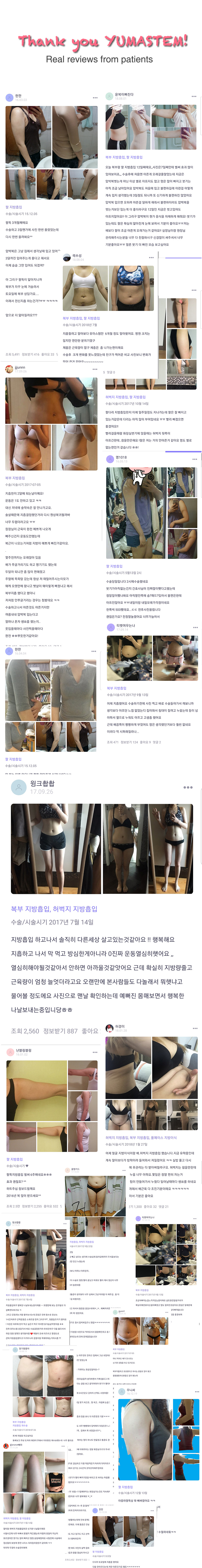 A lot of Real review of YUMASTEM's patients. Arms, armpit fat, abdomen, stomach, love handle all the area of liposuction photos.